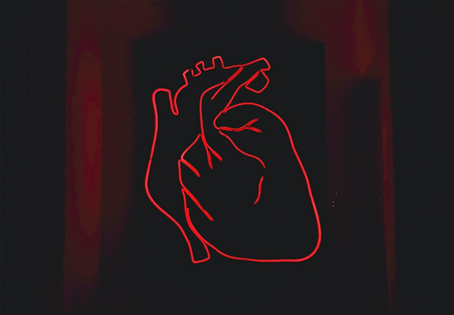 Transposicion de Grandes Arterias